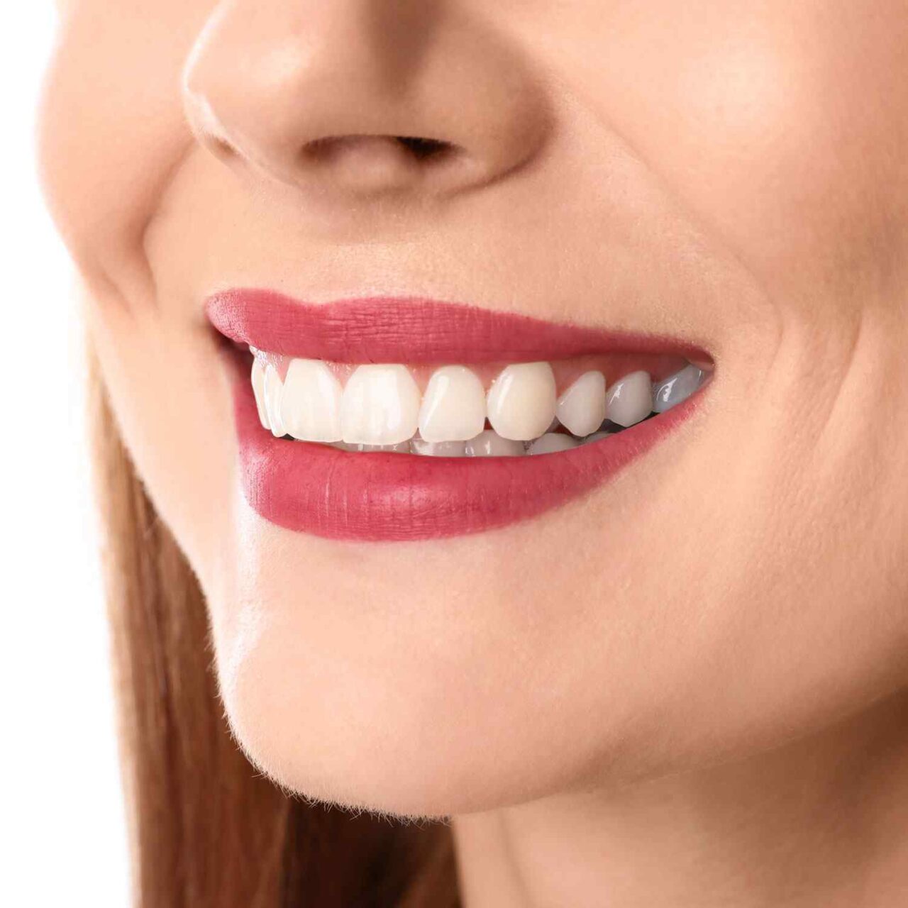 https://subtechdental.co.uk/wp-content/uploads/2020/03/service_whitening-1280x1280.jpg