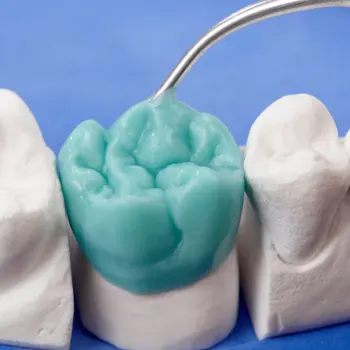 https://subtechdental.co.uk/wp-content/uploads/2023/10/Basic-wax-mock-up.webp