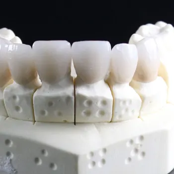 https://subtechdental.co.uk/wp-content/uploads/2023/10/Comprehensive-wax-mock-up.webp