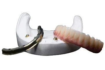 https://subtechdental.co.uk/wp-content/uploads/2024/11/Digital-Workflow.webp